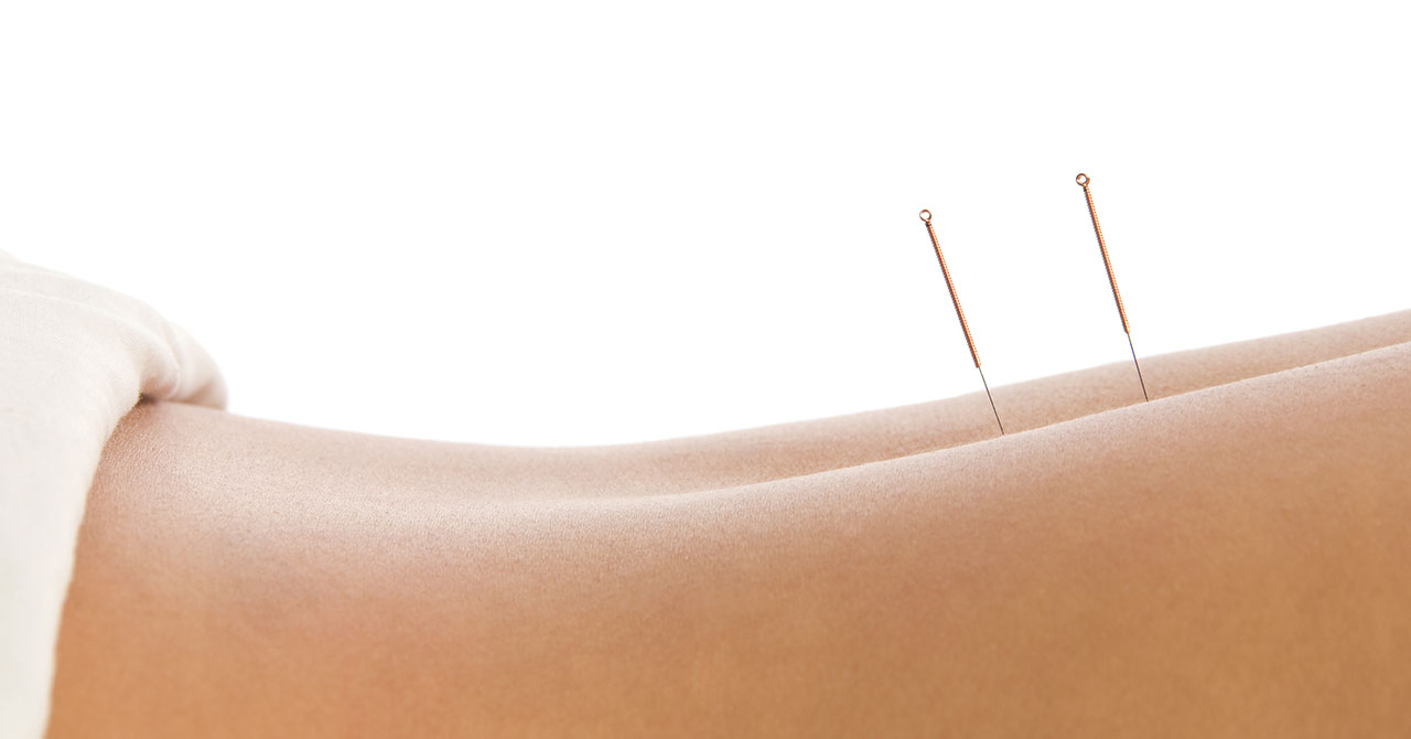 Acupunctuur Haarlem Acupuncturist