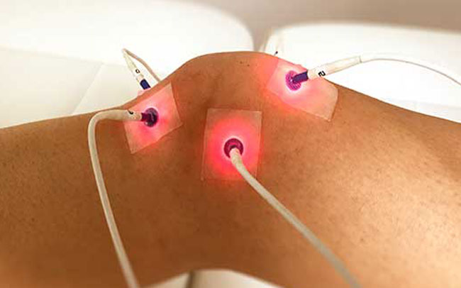 Laseracupunctuur Laser Acupunctuur Haarlem