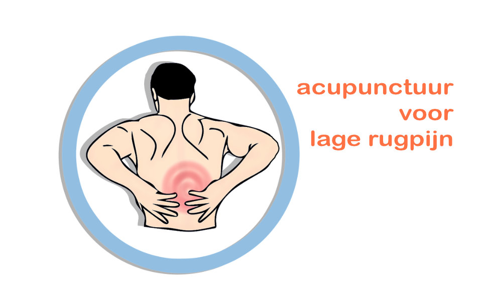 Acupunctuur voor lage rugpijn