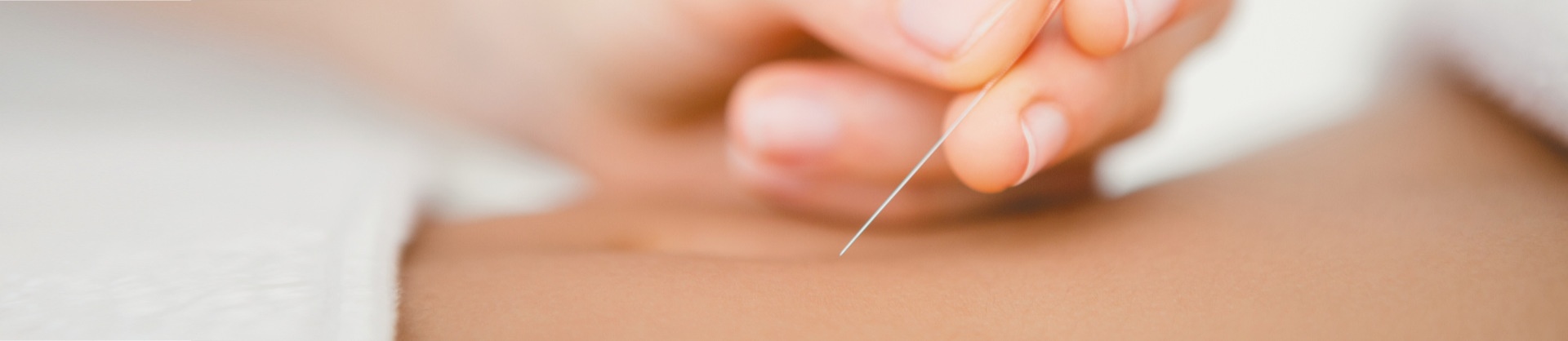 Acupunctuur tarief acupuncturist