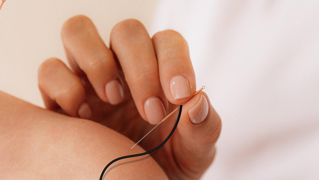 Elektro acupunctuur