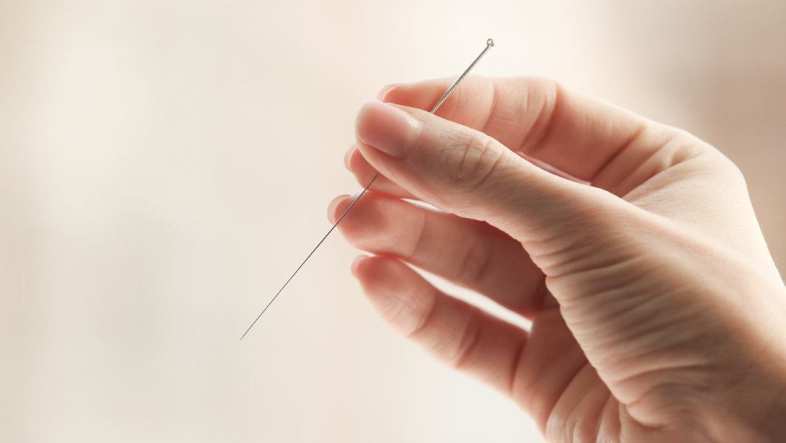 Japanse acupunctuur