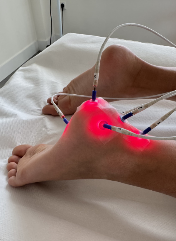 Laseracupunctuur jongen