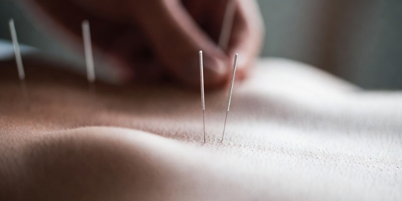 Veiligheid van acupunctuur