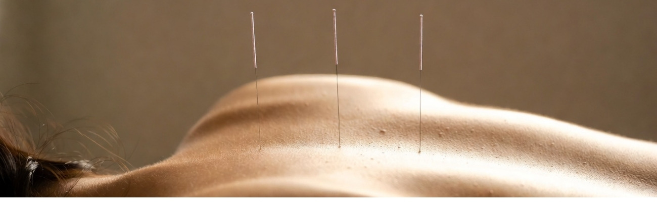 Acupunctuur bij pijn